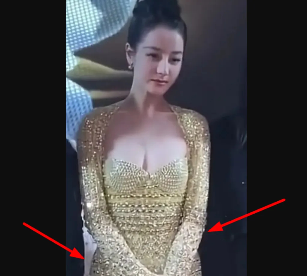 热巴生娃风波越闹越大！网友找出照片，曾经肿了胖了半年多没拍戏插图1