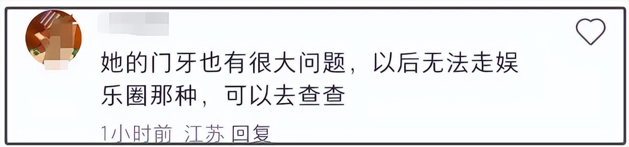 森碟下巴后缩挺严重的，田亮说已经在矫正了，去年就有网友看出不对劲了插图