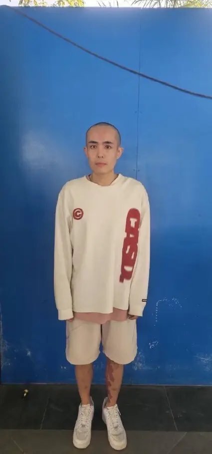 泰媒曝光王星最新照片，头剃光了额头还红肿，家人说他状况不佳插图2