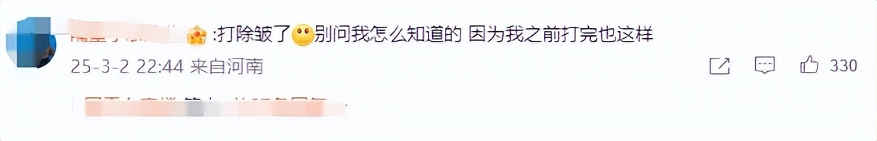 戚薇上节目被吐槽整容过度，眼睛肿得像条线，细数她的变脸历程，越看越奇怪插图1